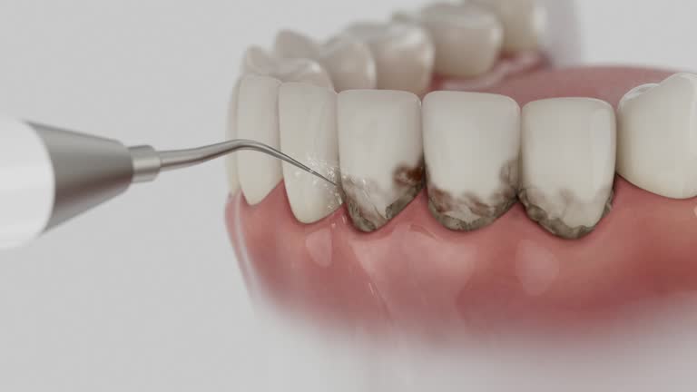 Trusted Dental Implants service in Bethel, WA - Dentist Open Now